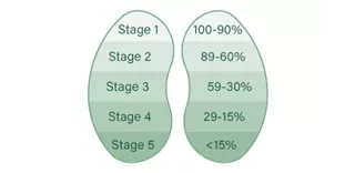 Chart of kidneys showing the percentage of kidney function for each stage of CKD, where stage 1 is 100 to 90 percent, and stage 5 is less than 15 percent